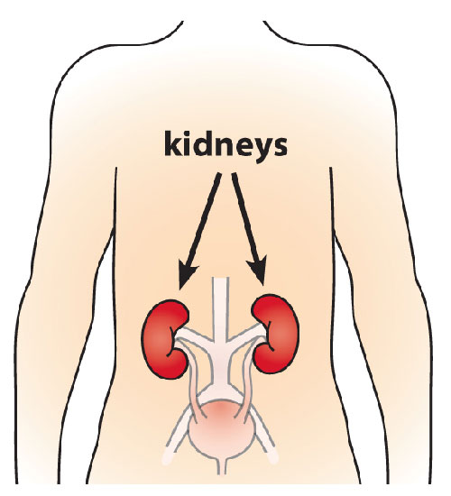 overview-kidney-stone.jpg